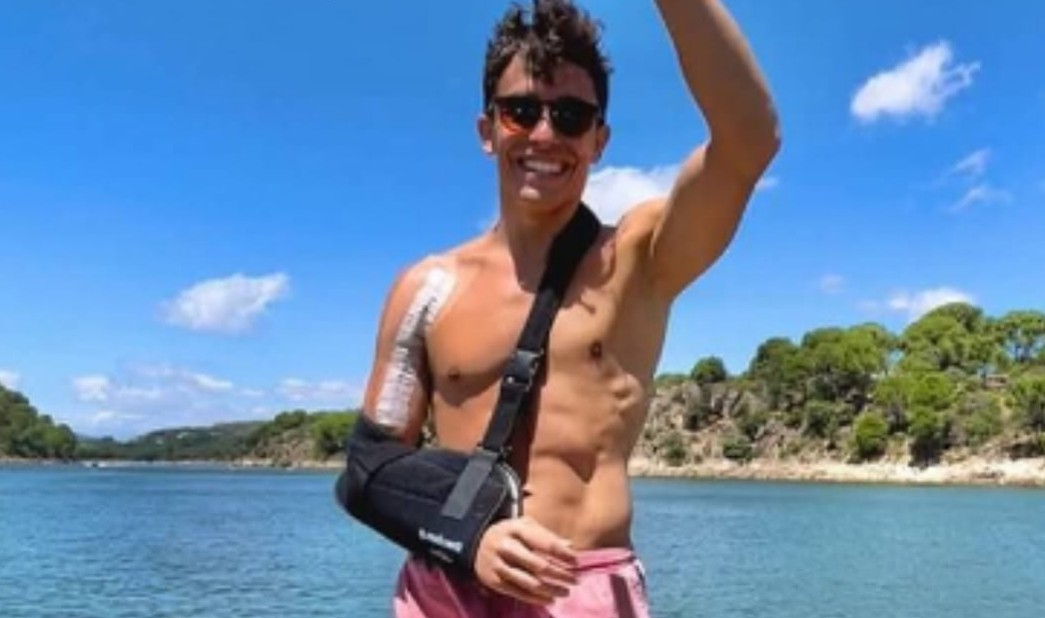 Marc Marquez Bahu Danau Otoplasa Marc Marquez sekrup