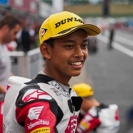 Veda Ega Pratama Otoplasa 2 Veda Ega Pratama
